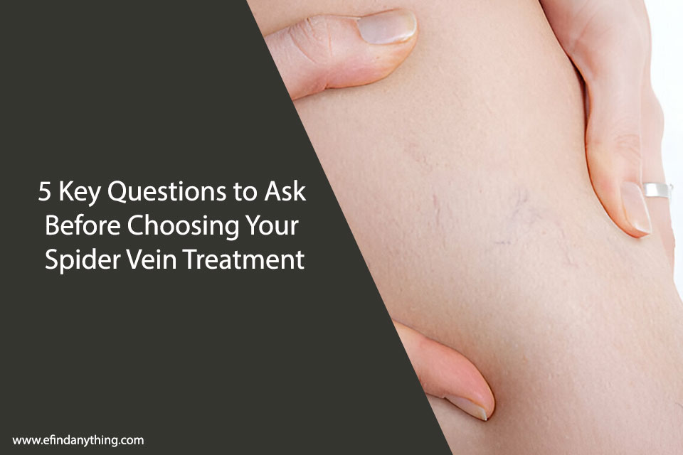 5 Key Questions to Ask Before Choosing Your Spider Vein Treatment