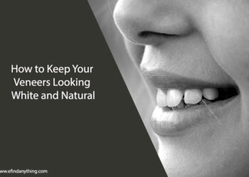 How to Keep Your Veneers Looking White and Natural