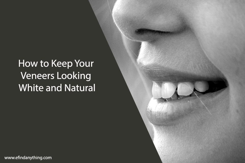 How to Keep Your Veneers Looking White and Natural