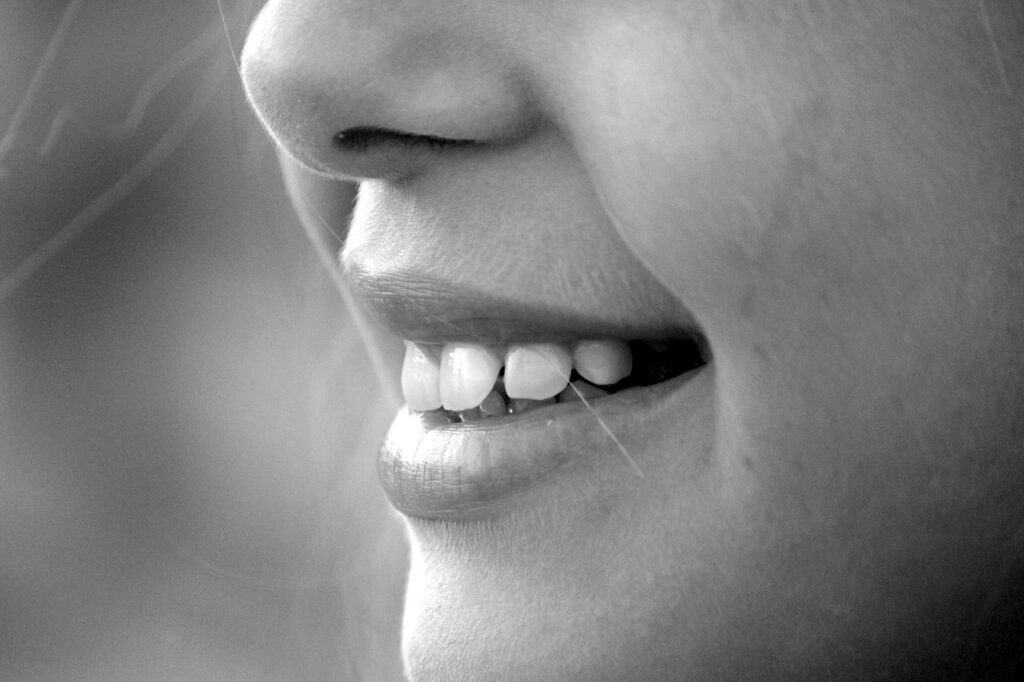 How to Keep Your Veneers Looking White and Natural