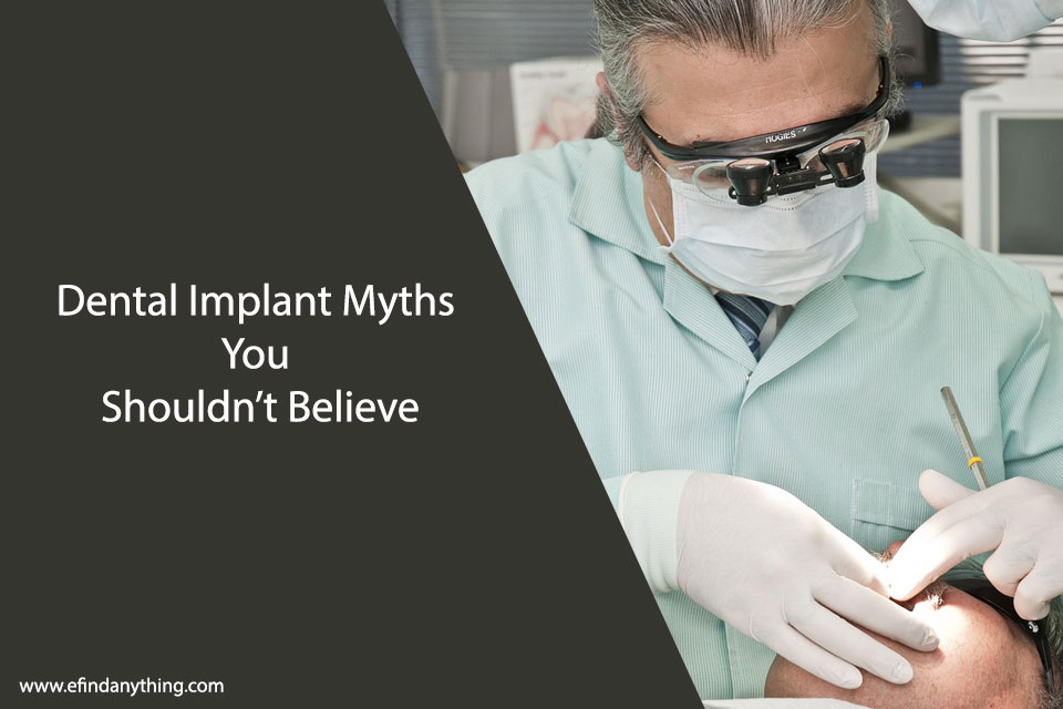 Dental Implant Myths You Shouldn’t Believe