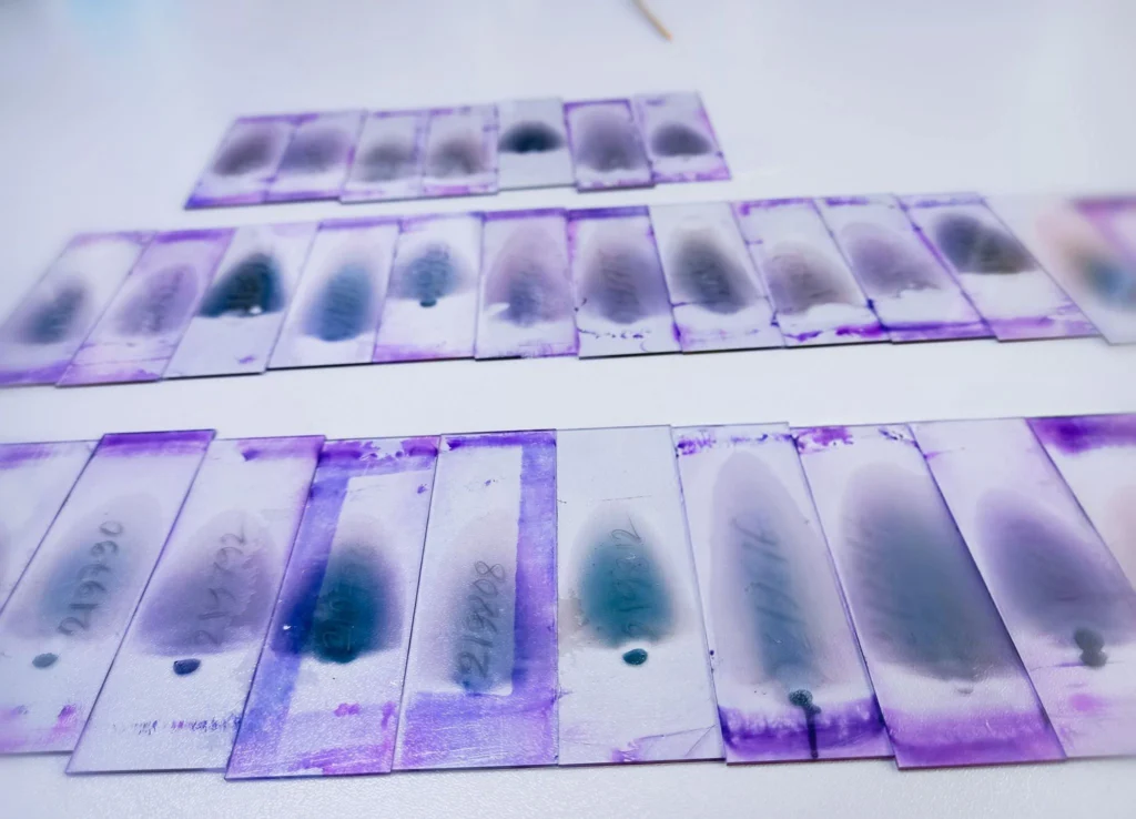 How FFPE Slides Support Pathology and Molecular Analysis