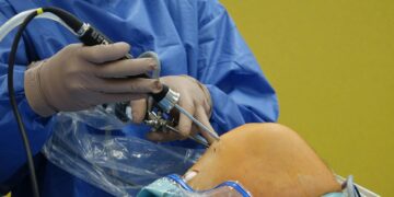 minimally invasive knee surgery recovery timeline