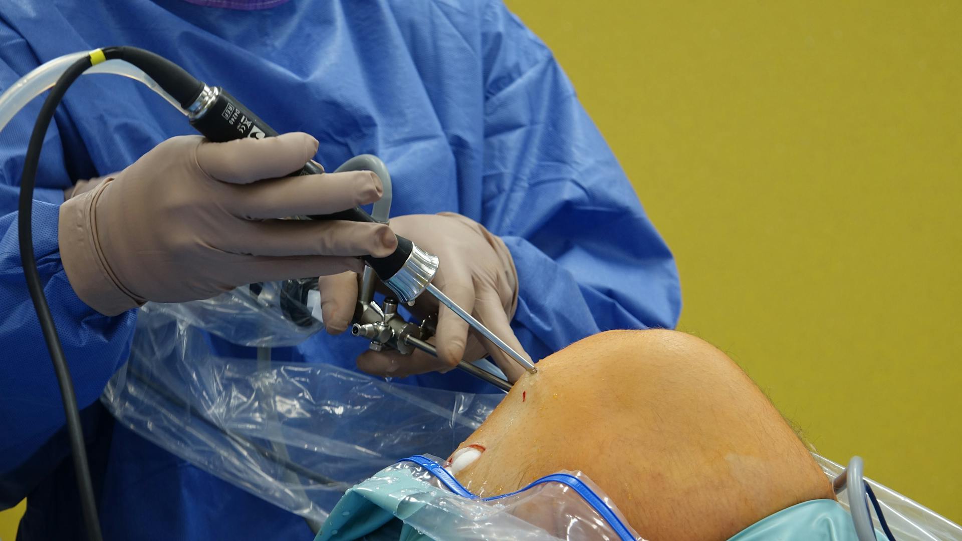 minimally invasive knee surgery recovery timeline